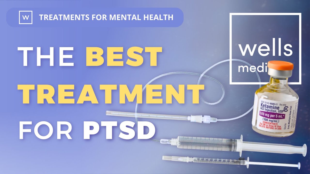 Ketamine VS SGB For PTSD