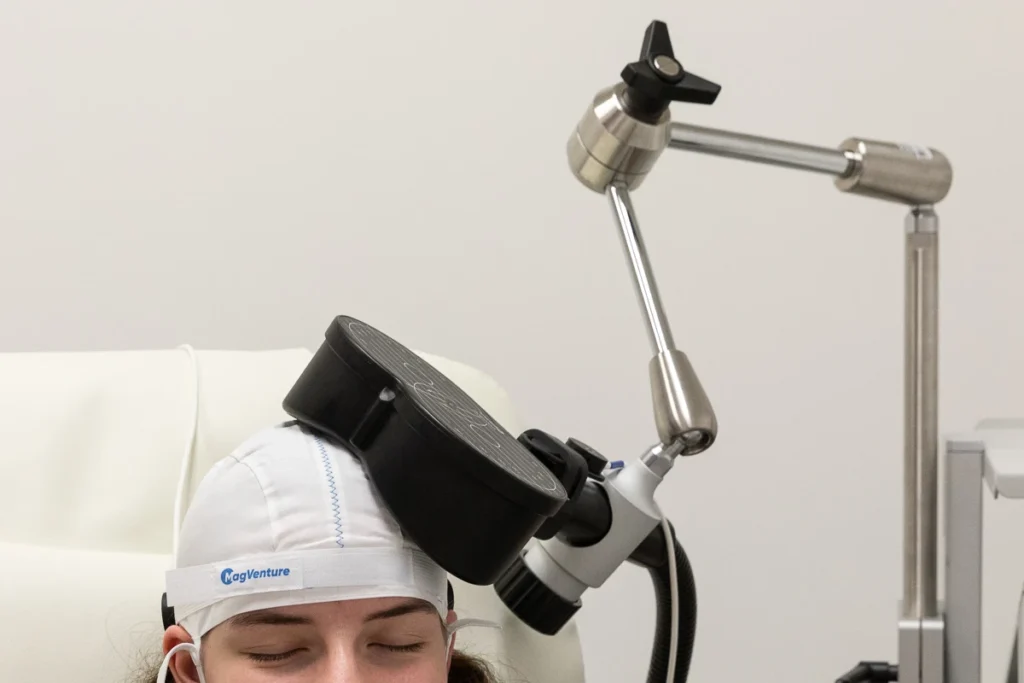 2025-02 Wells Medicine - TMS - C17A5589 Patient receiving Transcranial Magnetic Stimulation (TMS) therapy with coil positioned on head